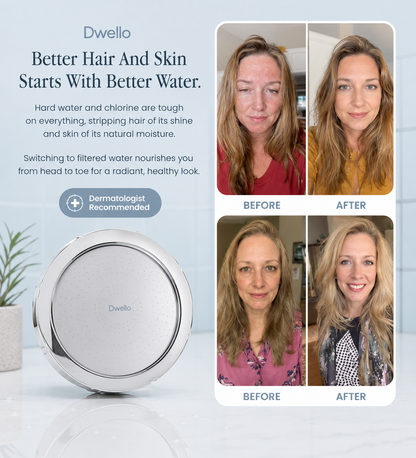 Before and after customer results showing healthier skin, improved hair appearance, and enhanced hydration after switching to the Dwello filtered shower head with advanced water filtration.
