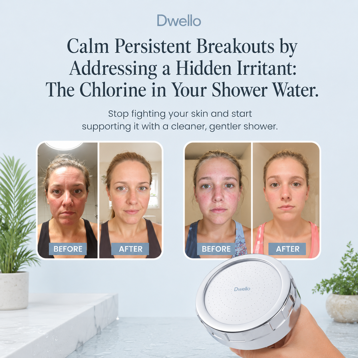 Before and after customer results showing clearer healthier-looking skin after using the Dwello filtered shower head to reduce chlorine exposure and improve shower water quality.