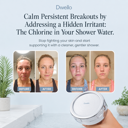 Before and after customer results showing clearer healthier-looking skin after using the Dwello filtered shower head to reduce chlorine exposure and improve shower water quality.