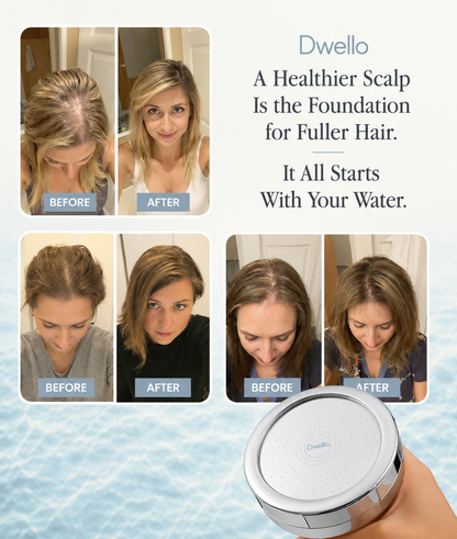 Before and after customer results showing improved scalp health and fuller-looking hair after using the Dwello filtered shower head with advanced water filtration technology.